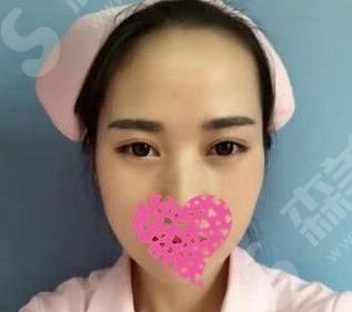 河南整形医院前列——郑州帝尔美整形美容医院案例分享 河南整形医院前列的医院信息查询,帝尔美医院医生简介及案例分享