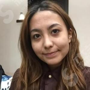 热玛吉治疗前的重要了解事项.jpg 热玛吉官网怎么查询?术前术后注意事项&案例果图