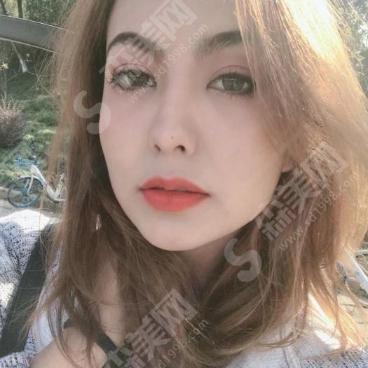 热玛吉的果该怎么保持.jpg 热玛吉官网怎么查询?术前术后注意事项&案例果图