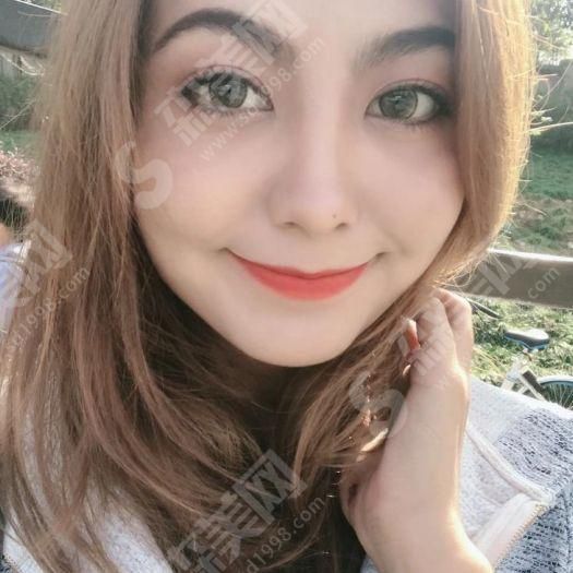 热玛吉的果该怎么保持.jpg 热玛吉官网怎么查询?术前术后注意事项&案例果图