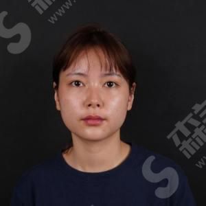 热玛吉的优势有哪些.jpg