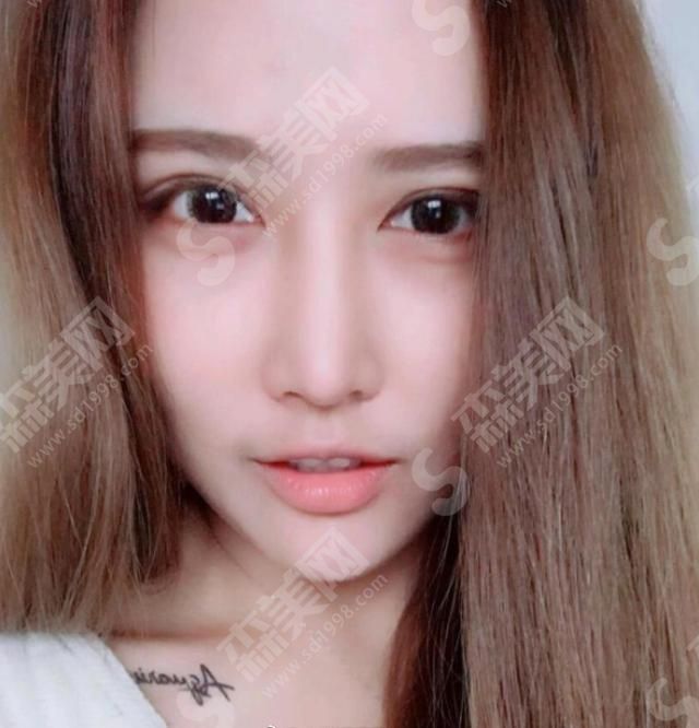 西安伊美尔整形医院口碑.jpg 西安伊美尔整形医院怎么样?医院概况/医生技术,附了眼部手术的案例果图!