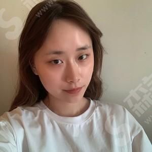 大同美神整形医院双眼皮的果.jpg