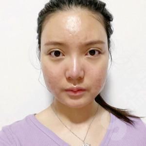 上海九院郭军医生颌面整形技术.jpg 上海九院郭军颌面整形案例分享!医生技术口碑好吗?真人案例果赏析