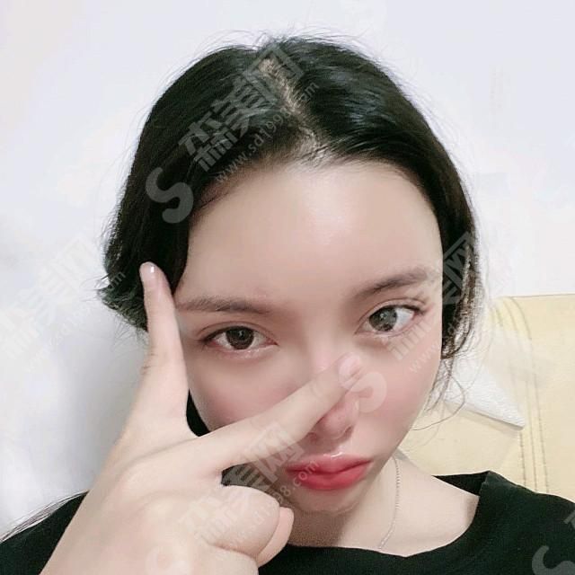 上海九院郭军医生颌面整形的果.jpg 上海九院郭军颌面整形案例分享!医生技术口碑好吗?真人案例果赏析