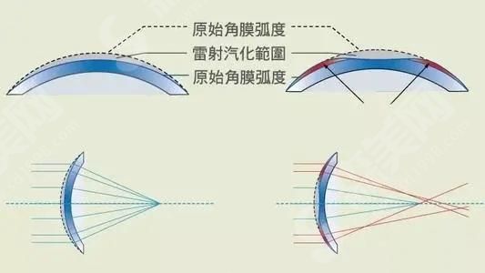 合肥近视矫正手术医院排名.jpg 合肥近视矫正手术医院排名名单是怎么样的?合肥105医院、合肥滨湖医院等均已上榜!