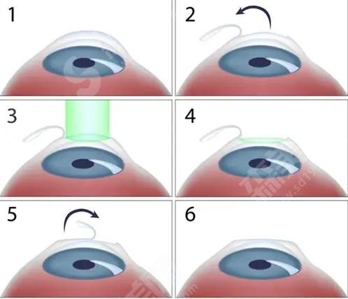 合肥近视眼手术医院排名榜分享！合肥普瑞眼科、科大眼科、合肥东南眼科的实力介绍！