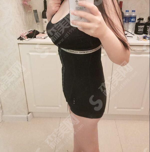 吸脂果.jpg 安徽省立医院美容整形外科怎样?吸脂的技术好吗&医院实力/团队医生