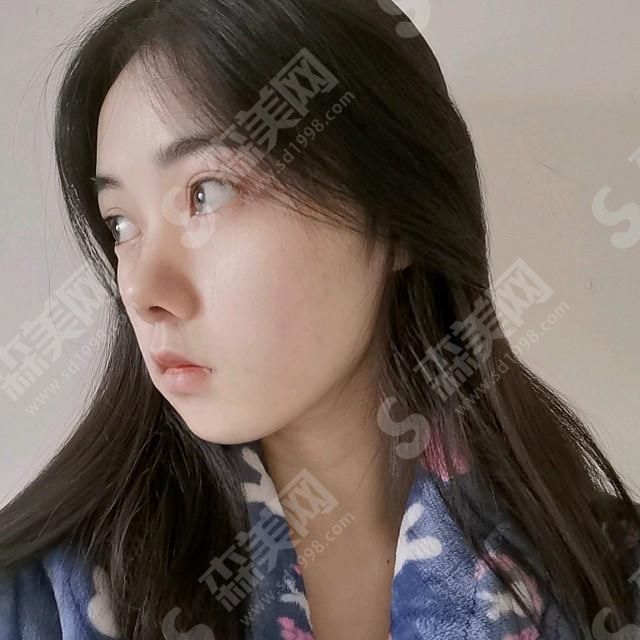 1632982659503221.jpg 西京医院隆鼻技术怎么样?综合实力好吗?隆鼻的案例果赏析!