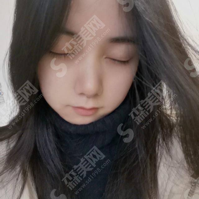 1632982667200745.jpg 西京医院隆鼻技术怎么样?综合实力好吗?隆鼻的案例果赏析!