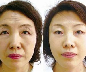 解放军153中心医院整外科情况?郭金华医生擅长技术及相关案例?