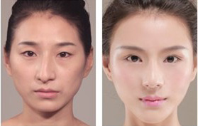 鹏爱医院的热玛吉真吗