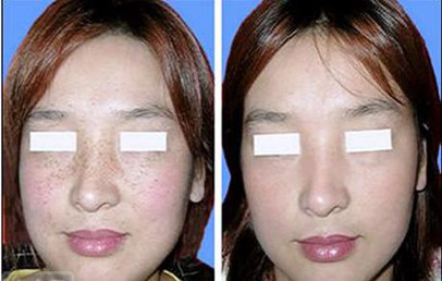 上海皮肤病专科医院地址在哪里