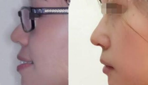 深圳口腔医院哪家好啊