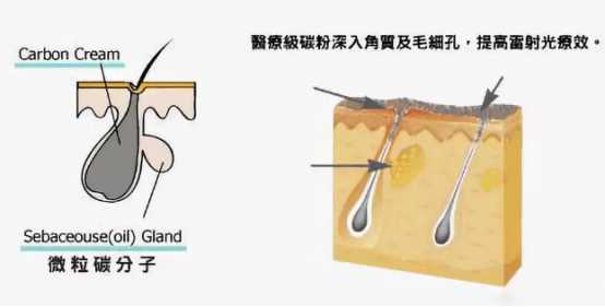 黑脸娃娃疗程是怎样的?有哪些需要注意的事项?