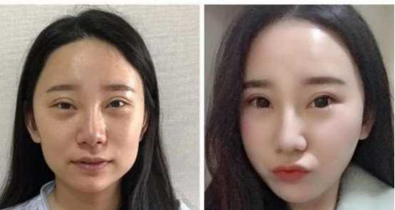 整形医生田欢怎么样?有没有什么案例?