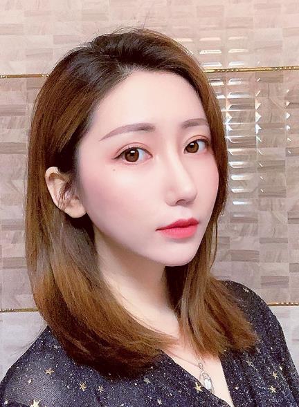 几万块做的自体肋软骨隆鼻果超赞，毫不后悔