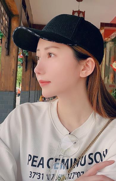 几万块做的自体肋软骨隆鼻果超赞，毫不后悔