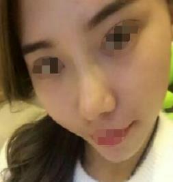 上海名格医疗美容门诊部的介绍-医生介绍-分享案例-项目价格怎么样？