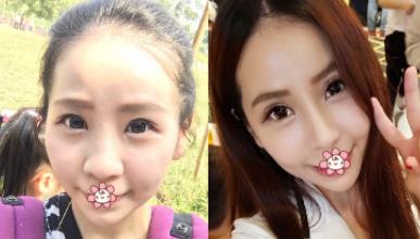 台湾星和医疗美容诊所的简介,口碑如何-医生信息-隆鼻案例-项目价格贵不贵