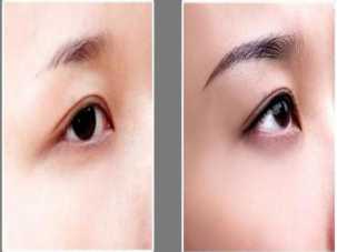 义乌纹眉欧莱美口碑如何？纹眉术后需要注意什么？