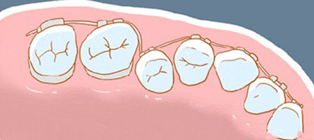 成都博爱牙齿矫正前后对比照片,博爱做的牙齿矫正能不能使笑容变得美丽?