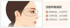 去除鱼尾纹医院哪家好?注射瘦脸注射真的能够改善鱼尾纹吗?