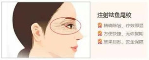 去除鱼尾纹医院哪家好?注射瘦脸注射真的能够改善鱼尾纹吗?