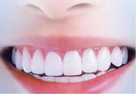 北京仁雁口腔医院怎么样？有什么真实的案例吗？