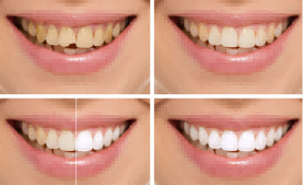 北京仁雁口腔医院怎么样？有什么真实的案例吗？