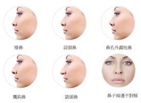 武汉的徐国建医生隆鼻怎么样？有没有人不适合隆鼻？