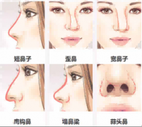 张姬珍医生擅长的手术是什么？她都有什么成功案例？