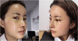 张姬珍医生擅长的手术是什么？她都有什么成功案例？