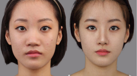 张姬珍医生擅长的手术是什么？她都有什么成功案例？