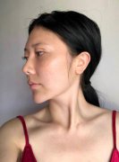 深圳春天医院怎么样？眼部手术修复手术附真人照片