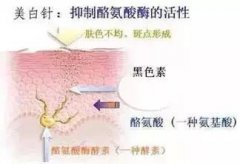 美白整形医院有吗?注射美白后皮肤有什么变化?