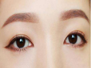 北京超声波去眼袋怎么做的?价格如何?