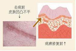 重庆骑士医院唐维礼医生怎么样?技术好吗?有没有真实的案例分享?