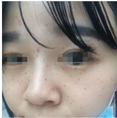 王文娟医生技术怎么样？她在哪家医院？案例有吗？