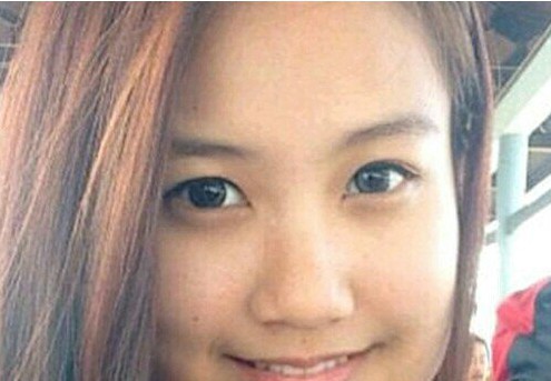 侯舍予医生做面部填充靠谱吗?有没有案例分享?