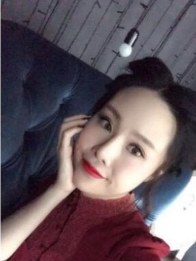 侯舍予医生做面部填充靠谱吗?有没有案例分享?