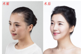 苏州哪家医院植发技术更好?苏州医院排行