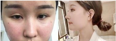 成都米亚医学美容医院好不好?具体案例有吗?