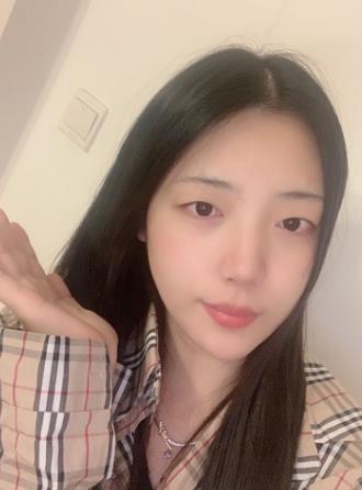 宏康医院皮肤科光子嫩肤果好不好?术后四十天的恢复日记