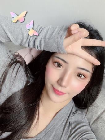 宏康医院皮肤科光子嫩肤果好不好?术后四十天的恢复日记