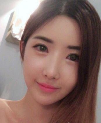 汪良明医生个人简介-擅长项目-五官整形案例-希思特美容医院