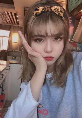 深圳和平医院面部脂肪填充果？附真人前后对比图