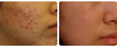 整形医生罗玲在皮肤治疗方面有着怎样的实力?案例分享---价格查询