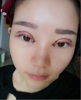 整形医生薄金盏在哪家医院?技术如何?有没有案例分享?