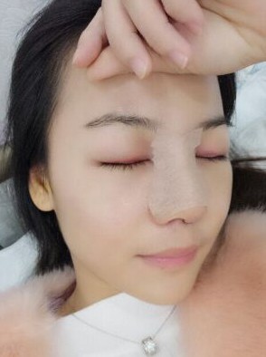 大连黄海医院做整形怎么样?有没有真实案例?